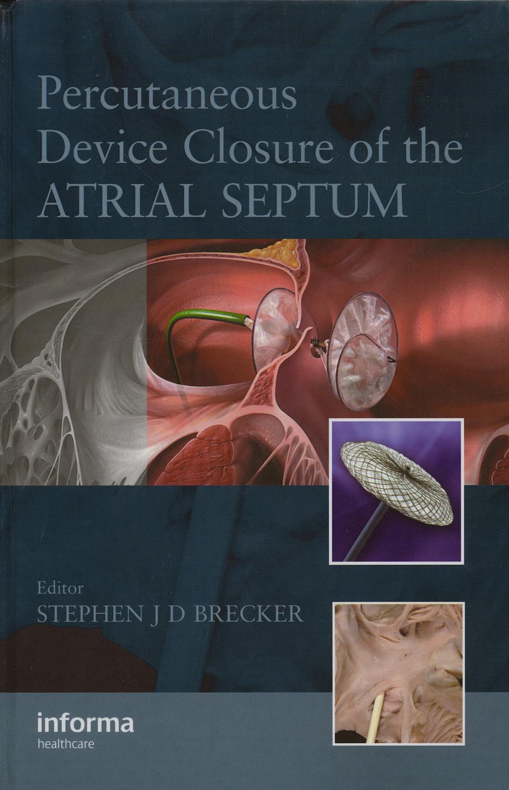 Portada del libro 9781841845968 Percutaneous Device Closure of the Atrial Septum