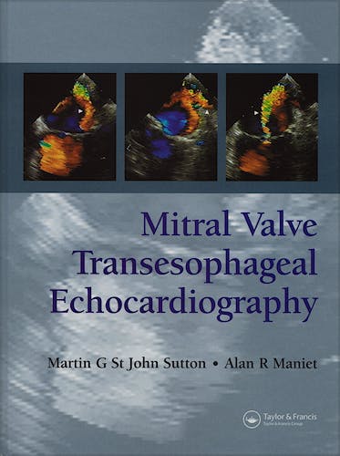 Portada del libro 9781841846088 Mitral Valve Transesophageal Echocardiography
