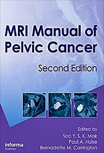 Portada del libro 9781841846767 Mri Manual of Pelvic Cancer