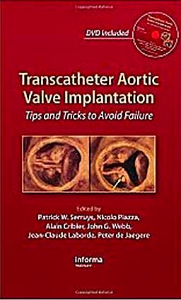 Portada del libro 9781841846897 Transcatheter Aortic Valve Implantation. Tips and Tricks to Avoid Failure + Dvd
