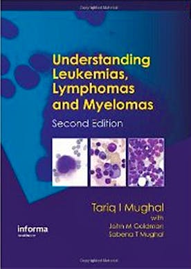 Portada del libro 9781841846941 Understanding Leukemias, Lymphomas and Myelomas