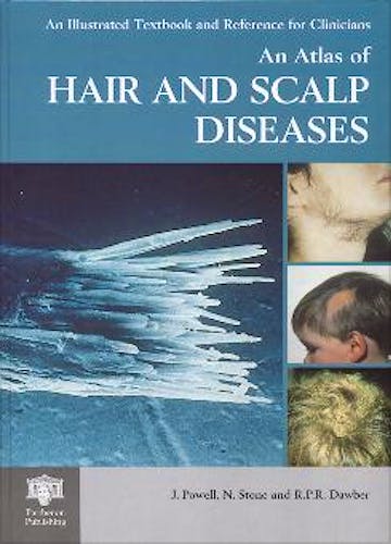 Portada del libro 9781842140130 An Atlas of Hair and Scalp Diseases