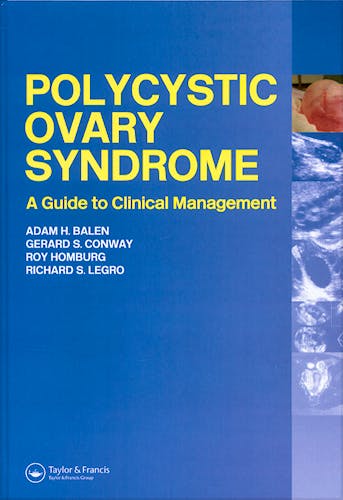 Portada del libro 9781842142110 Polycystic Ovary Syndrome a Guide to Clinical Management