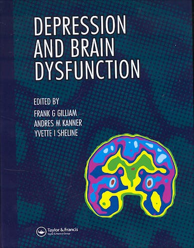 Portada del libro 9781842142141 Depression and Brain Dysfunction