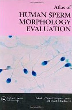 Portada del libro 9781842142776 Atlas of Human Sperm Morphology and Evaluation