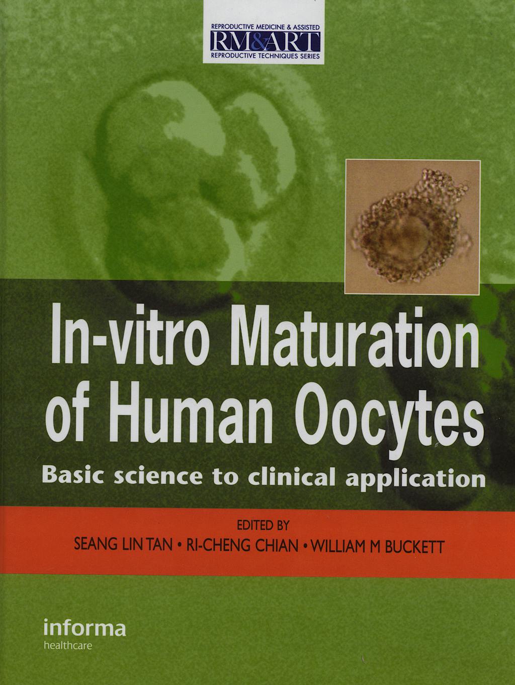 Portada del libro 9781842143322 In-Vitro Maturation of Human Oocytes. Basic Science to Clinical Applications