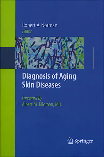Portada del libro 9781846286773 Diagnosis of Aging Skin Diseases