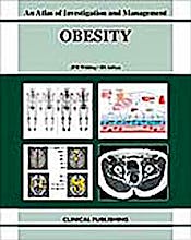 Portada del libro 9781846920271 Obesity. an Atlas of Investigation and Management