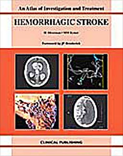 Portada del libro 9781846920394 Hemorrhagic Stroke. an Atlas of Investigation and Treatment