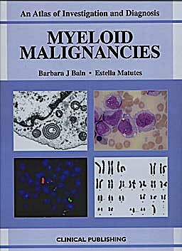 Portada del libro 9781846920554 Myeloid Malignancies. an Atlas of Investigation and Diagnosis