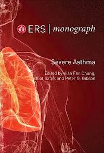 Portada del libro 9781849841030 Severe Asthma (ERS Monographs)