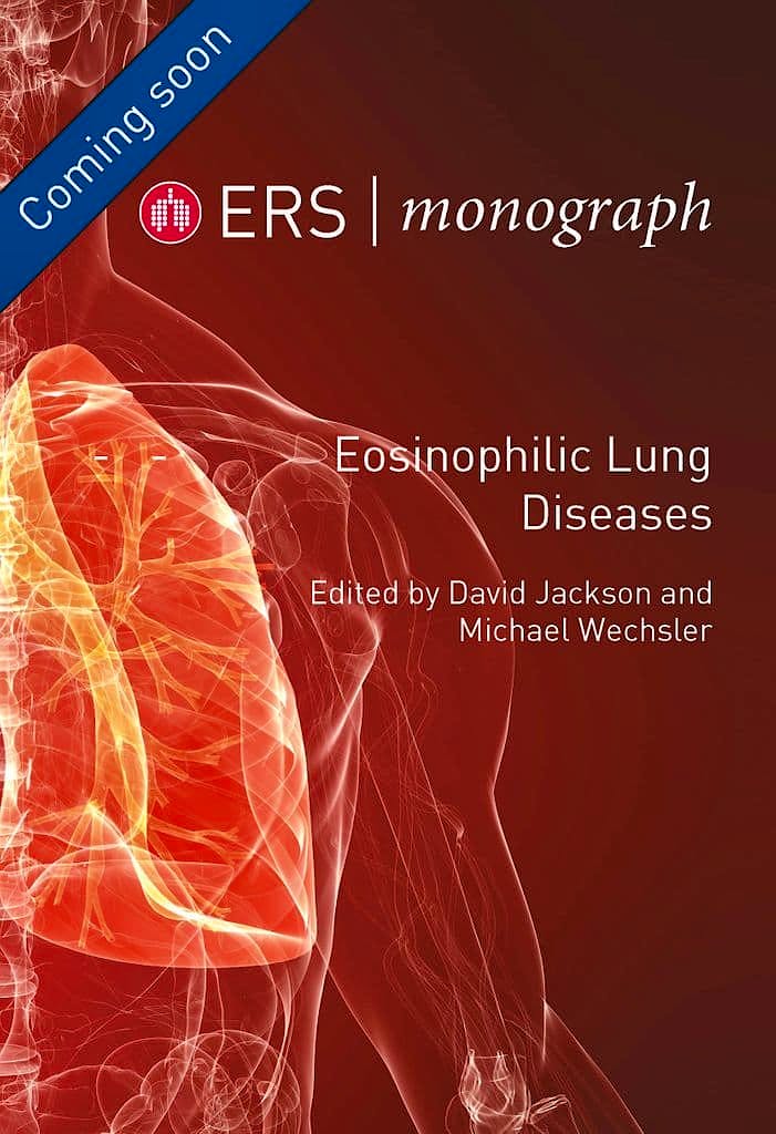 Portada del libro 9781849841429 Eosinophilic Lung Diseases (ERS Monographs)