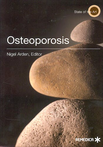 Portada del libro 9781850092056 Osteoporosis