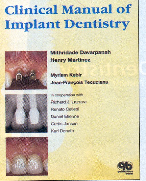 Portada del libro 9781850970491 Clinical Manual of Implant Dentistry