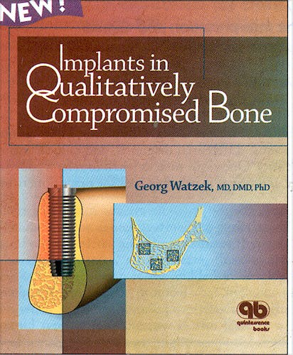 Portada del libro 9781850970507 Implants in Qualitatively Compromised Bone