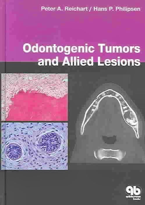 Portada del libro 9781850970590 Odontogenic Tumours and Allied Lesions