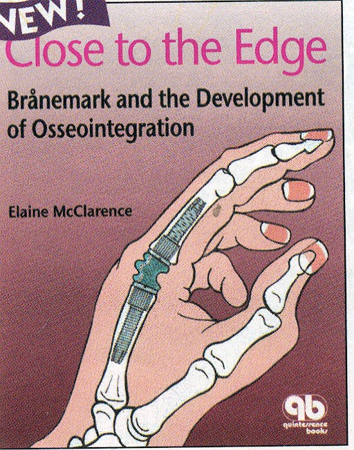 Portada del libro 9781850970675 Close to the Edge : Branemark and the Development of Osseointegration