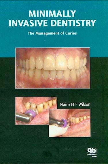 Portada del libro 9781850971054 Minimally Invasive Dentistry. the Management of Caries