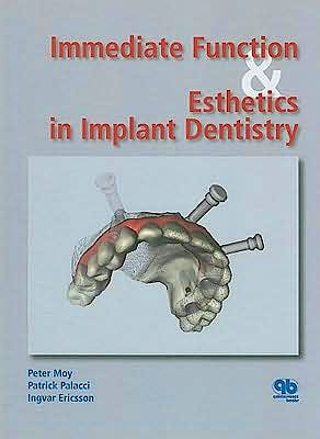 Portada del libro 9781850971733 Immediate Function & Esthetics in Implant Dentistry