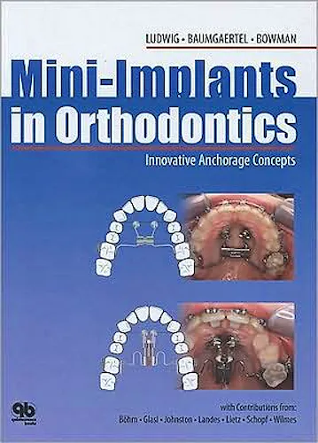 Portada del libro 9781850971740 Mini-Implants in Orthodontic. Innovative Anchorage Concepts
