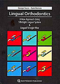 Portada del libro 9781850971924 Lingual Orthodontics. A New Approach Using Stb Light Lingual System and Lingual Straight Wire