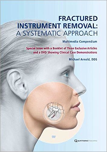 Portada del libro 9781850972730 Fractured Instrument Removal: A Systematic Approach