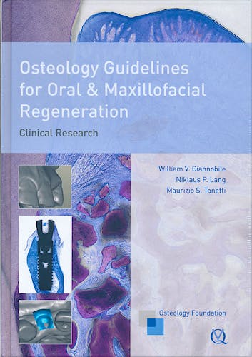 Portada del libro 9781850972747 Osteology Guidelines for Oral and Maxillofacial Regeneration. Clinical Research