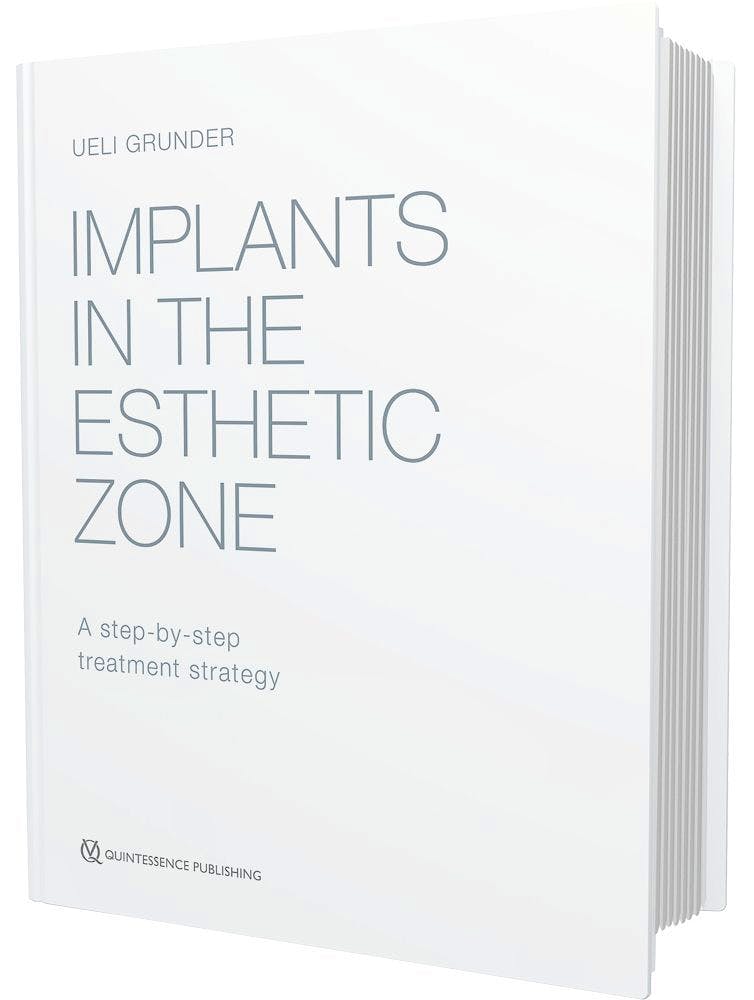 Portada del libro 9781850972839 Implants in the Esthetic Zone. a Step-by-Step Treatment Strategy