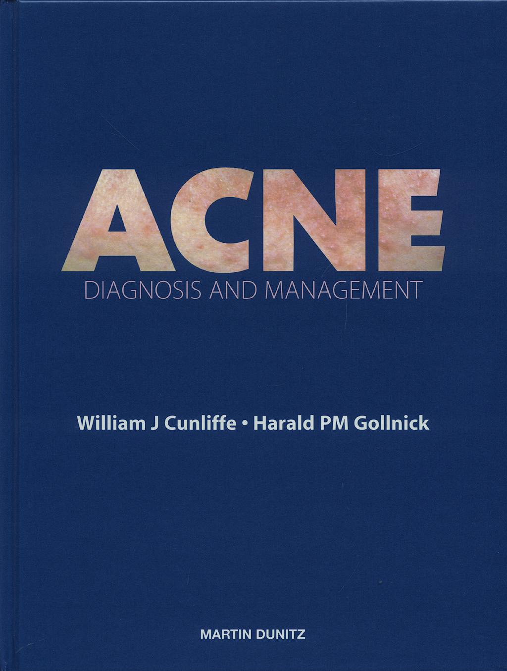 Portada del libro 9781853172069 Acne: Diagnosis and Management