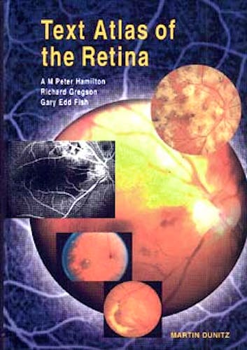 Portada del libro 9781853172267 Text Atlas of the Retina