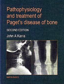 Portada del libro 9781853174636 Pathophysiology and Treatment of Paget's Disease of Bone