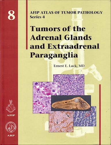 Portada del libro 9781881041016 Tumors of the Adrenal Glands and Extraadrenal Paraganglia (AFIP Atlas of Tumor Pathology Series 4, Vol. 8)