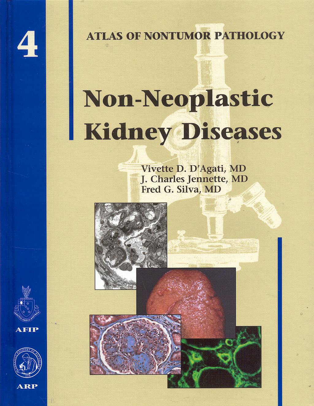 Portada del libro 9781881041962 Non-Neoplastic Kidney Diseases. Afip Atlas of Nontumor Pathology, Vol. 4