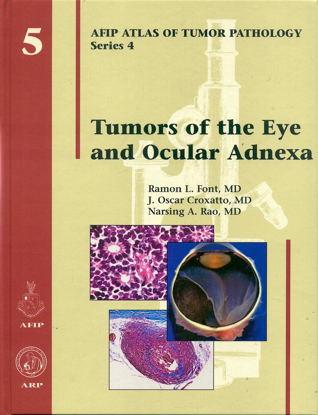 Portada del libro 9781881041993 Tumors of the Eye and Ocular Adnexa (AFIP Atlas of Tumor Pathology Series 4, Vol. 5)