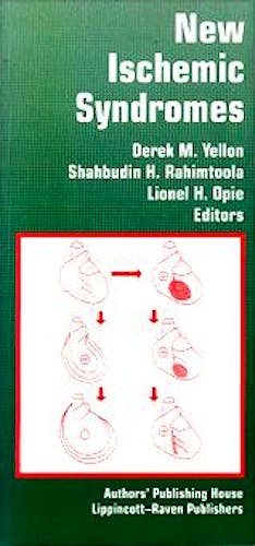 Portada del libro 9781881063063 New Ischemic Syndromes :Beyond Angina & Infarction