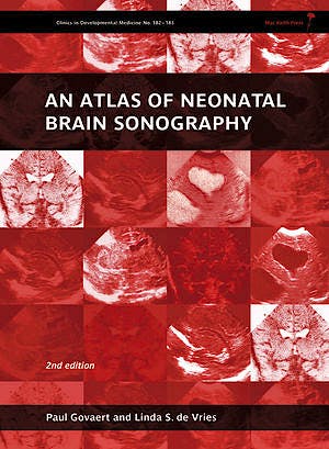 Portada del libro 9781898683568 An Atlas of Neonatal Brain Sonography (Clinics in Developmental Medicine Nº 182-183)