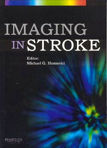 Portada del libro 9781901346251 Imaging in Stroke