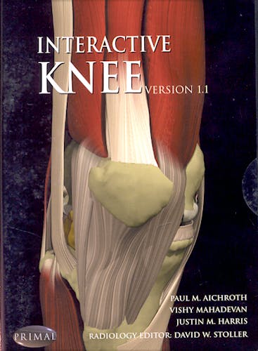 Interactive Knee (CD-ROM)