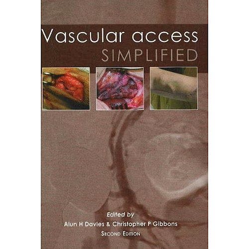 Portada del libro 9781903378526 Vascular Access Simplified