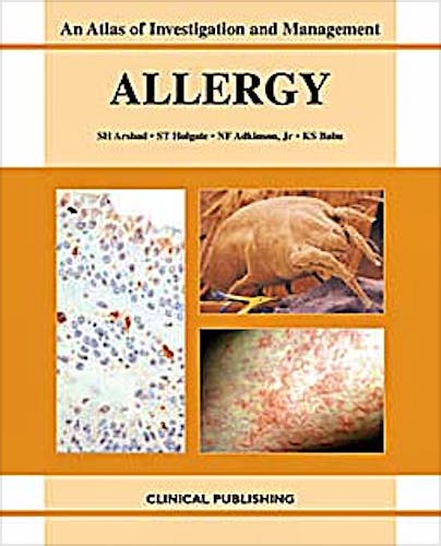 Portada del libro 9781904392248 Allergy: Atlas of Investigation and Management