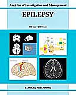 Portada del libro 9781904392545 Epilepsy. an Atlas of Investigation and Management