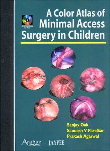 Portada del libro 9781904798187 A Color Atlas of Minimal Access Surgery in Children