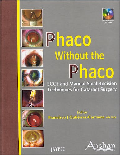 Portada del libro 9781904798507 Phaco without the Phaco. Ecce and Manual Small-Incision Techniques for Cataract Surgery