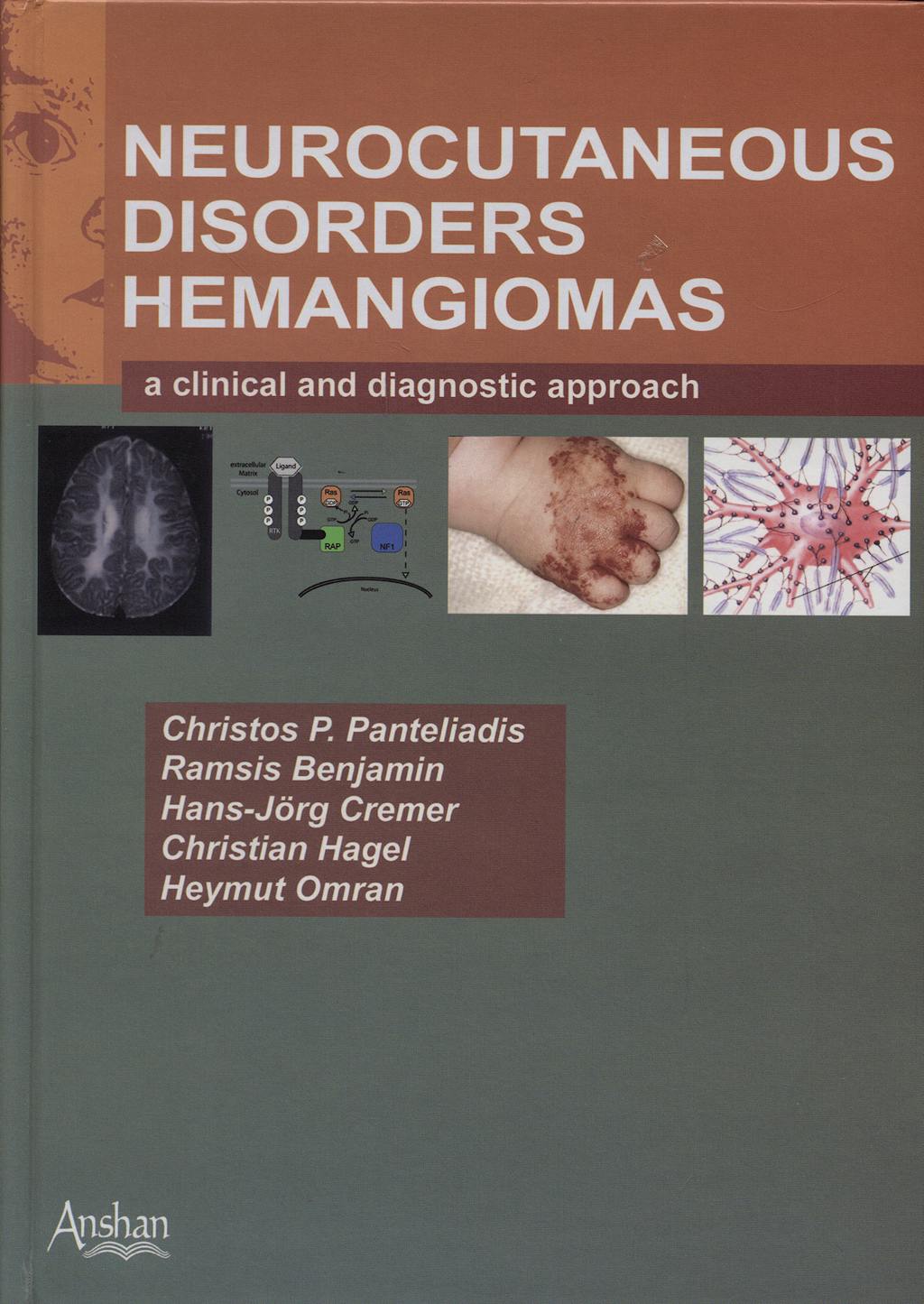 Portada del libro 9781905740642 Neurocutaneous Disorders Hemangiomas. a Clinical and Diagnostic Approa
