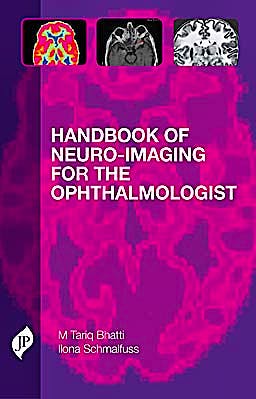 Portada del libro 9781907816130 Handbook of Neuro-Imaging for the Ophthalmologist