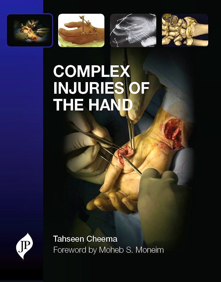 Portada del libro 9781907816253 Complex Injuries of the Hand