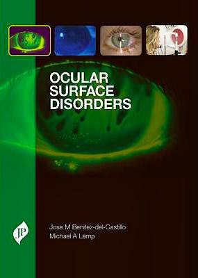 Portada del libro 9781907816314 Ocular Surface Disorders