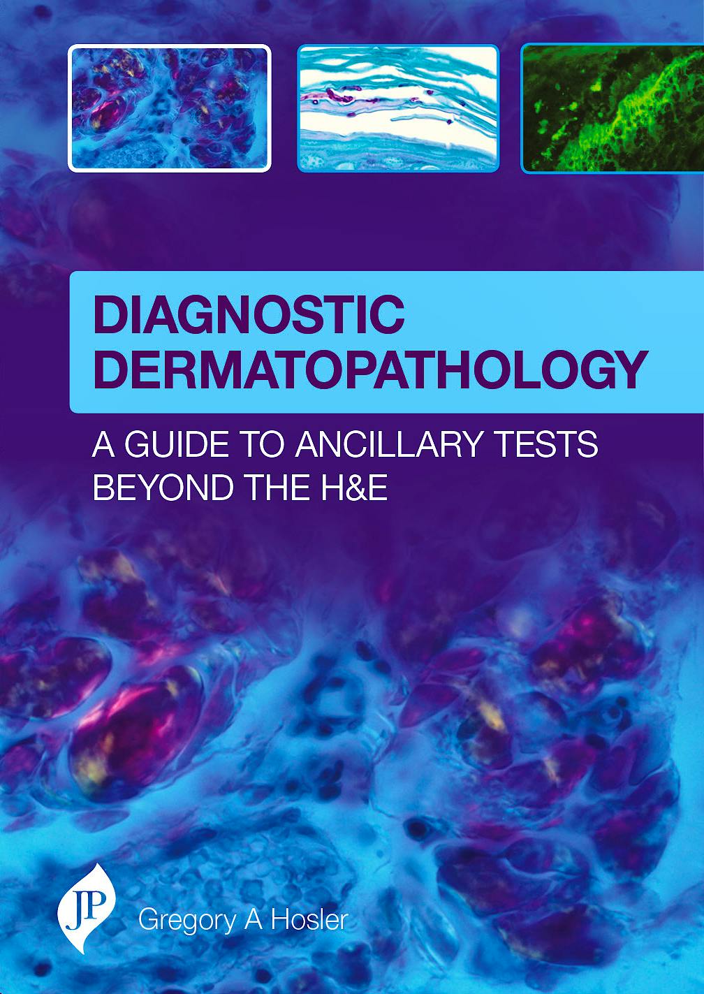 Portada del libro 9781909836129 Diagnostic Dermatopathology. A Guide to Ancillary Tests beyond the H&E
