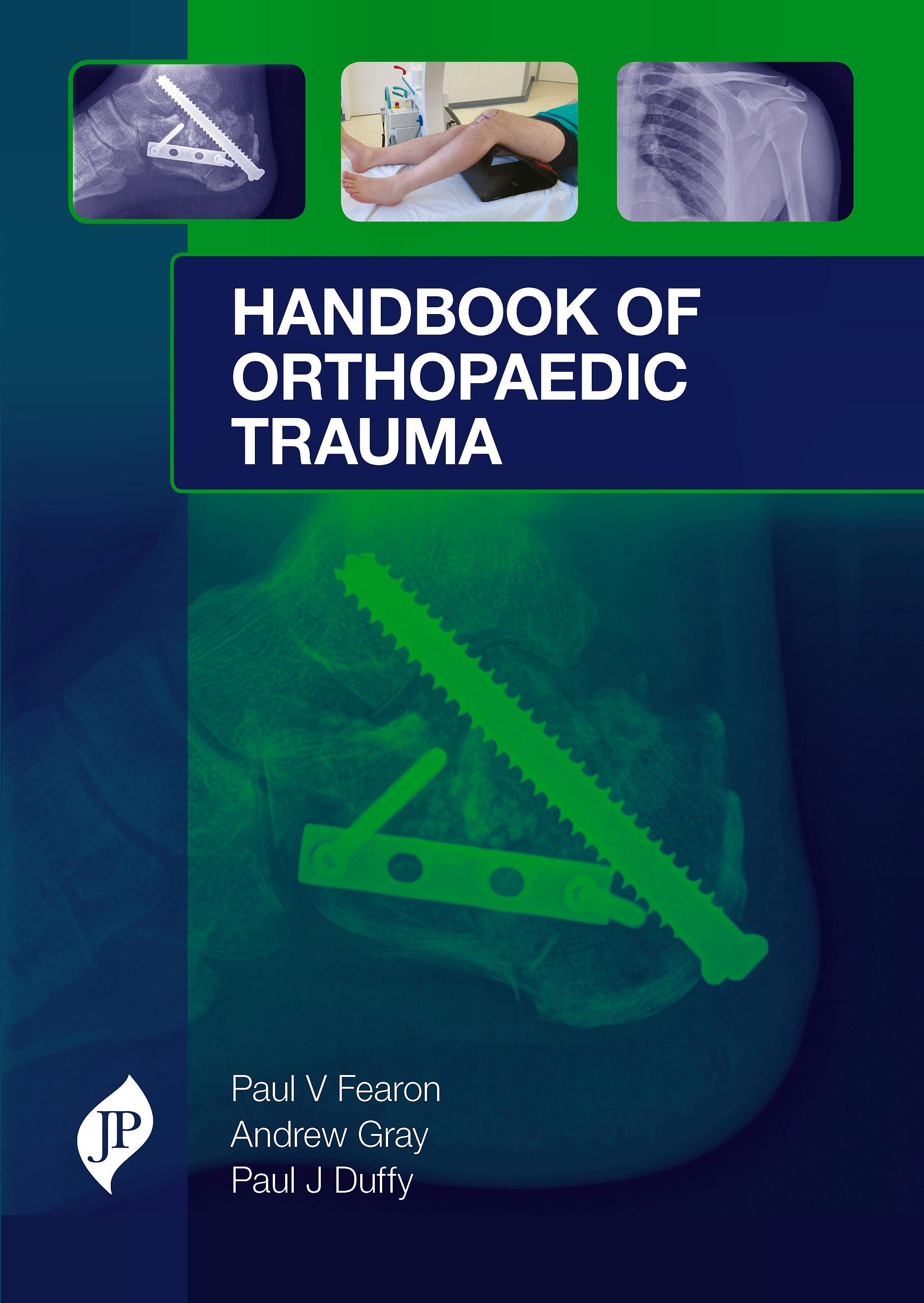 Portada del libro 9781909836150 Handbook of Orthopaedic Trauma