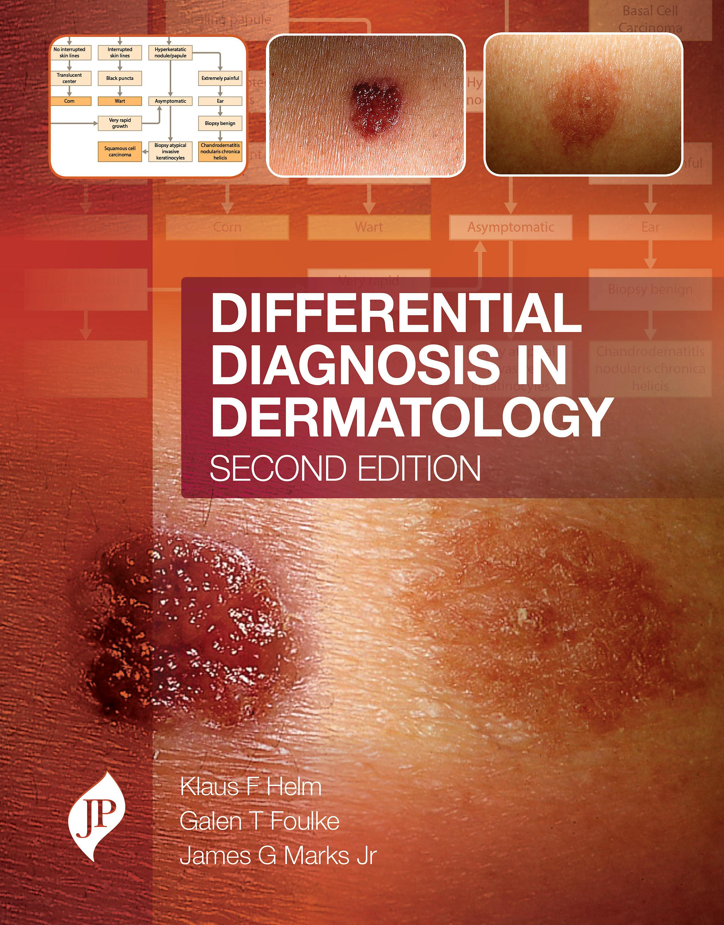 Portada del libro 9781909836198 Differential Diagnosis in Dermatology